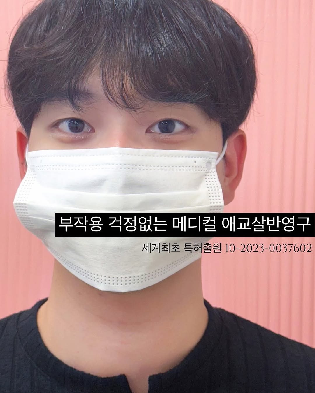 남성 메디컬 애교살 시술