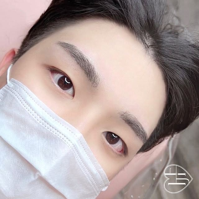 남자눈썹 시술 사례