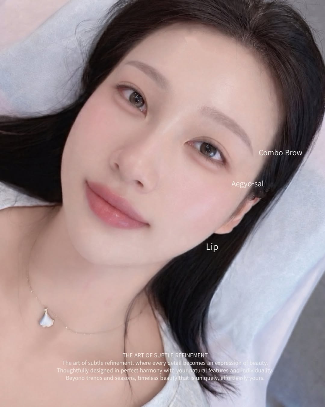 옴브레립 시술 사례